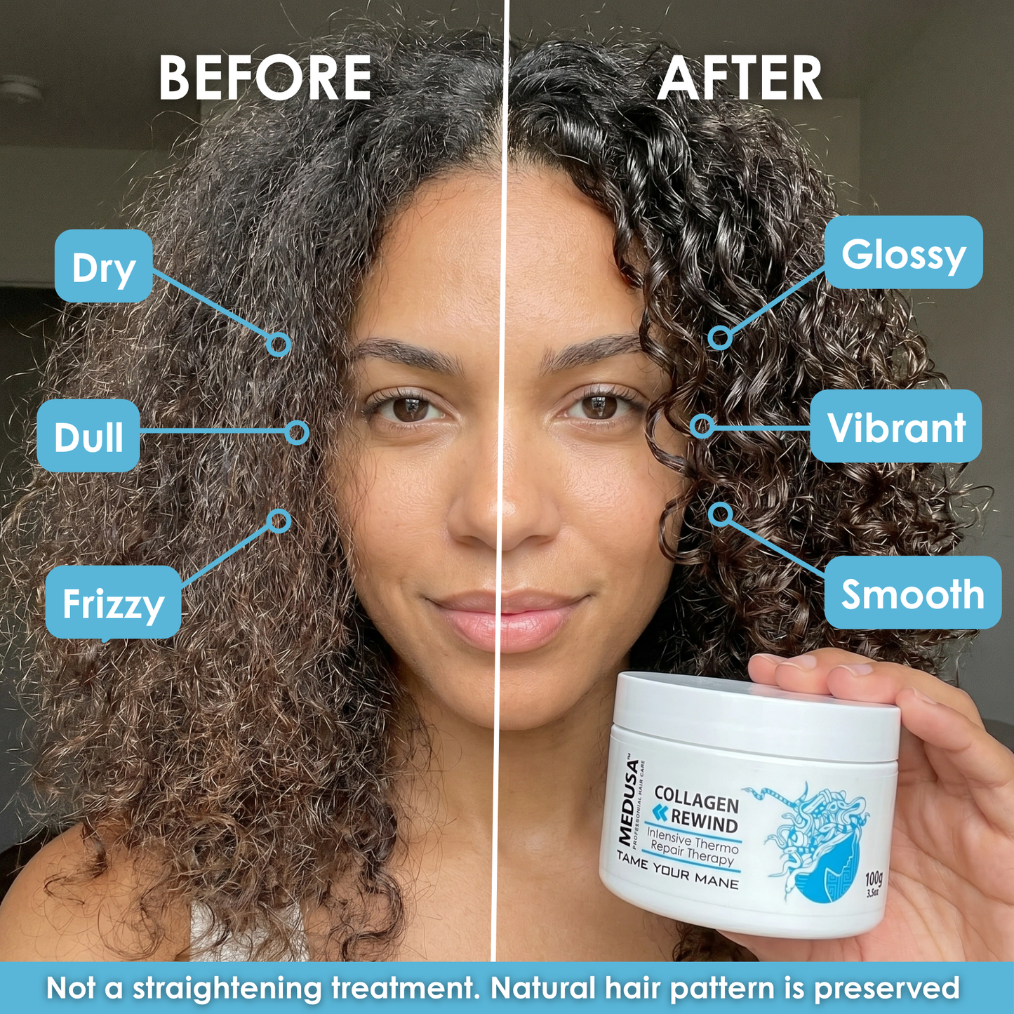 Botox Collagen Rewind
